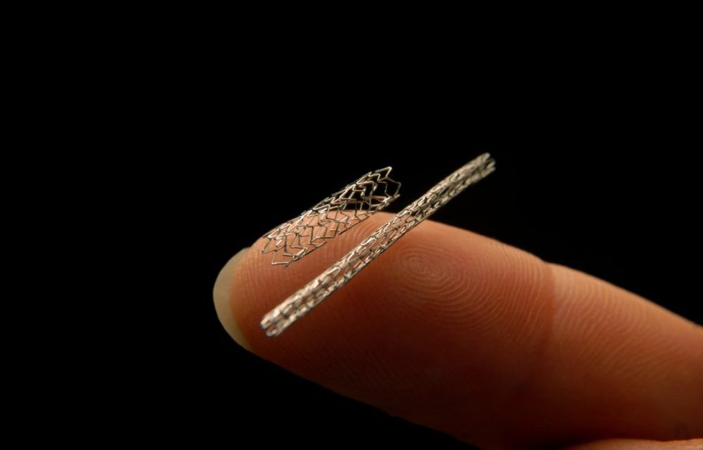 Inside the stent investigating the boom in cardiac surgery Michael West